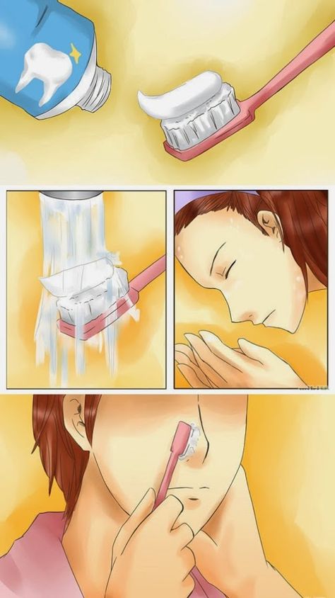 Remove blackheads from your skin by toothbrush and toothpaste Toothbrush And Toothpaste, Remove Blackheads, Get Rid Of Blackheads, Skin Issues, Blackhead Remover, Brushing, Facial Care, Facial Skin, Get In Shape