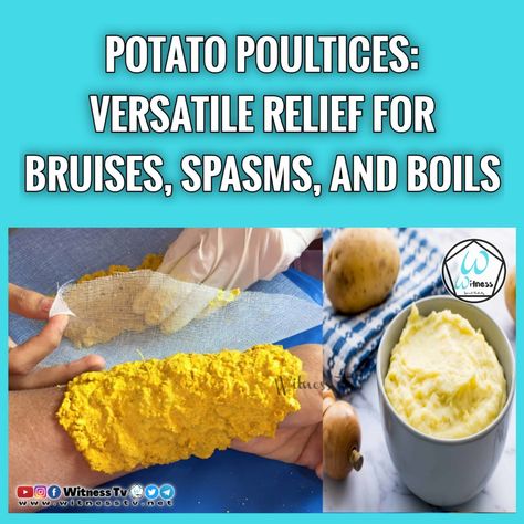 Discover the surprising benefits of Potato Poultices: Soothing bruises, relieving spasms, and aiding boils. Effective, natural, and easy to use. Potato Poultice, Benefits Of Potatoes, Grated Potato, Muscle Spasms, Boiled Potatoes, Skin Issues, Irritated Skin, Cleaning Clothes, Easy To Use