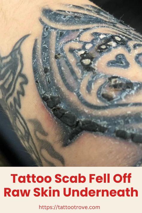 Tattoo Scab Fell Off Raw Skin Cracking Skin Tattoo, Skin Cracking Tattoo, Tattoo Artists Who Turned Scars And Birthmarks Into Works Of Art, Tattoo Scabbing, Never Be Ashamed Of A Scar, G Tattoo, Tattoo Care, Tattoo Aftercare, Skin