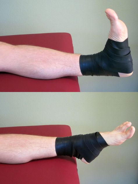 How to Self-Treat Posterior Tibialis Pain | Marathon Training Academy Posterior Tibialis, Posterior Tibial Tendon Dysfunction, Posterior Tibial Tendon, Strengthen Ankles, Ankle Strengthening Exercises, Foot Exercises, Physical Therapy Exercises, Running Program, Ankle Pain