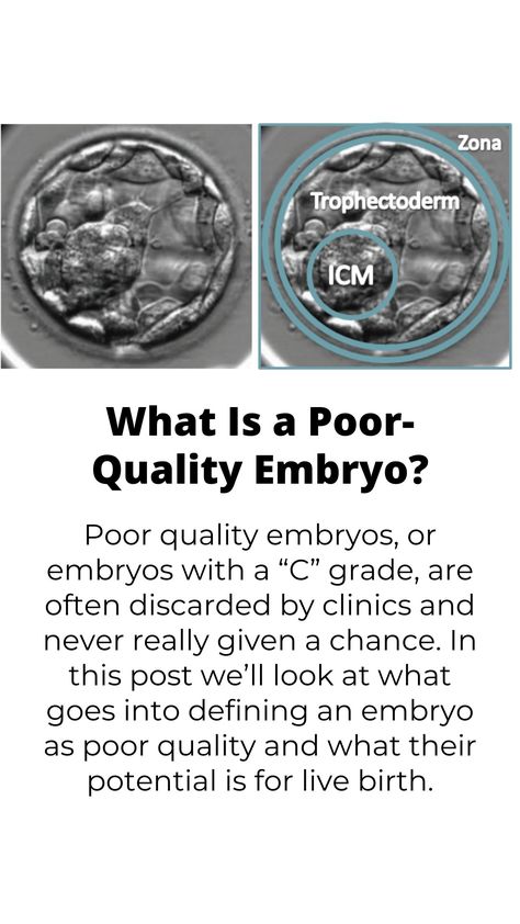 What Is a Poor-Quality Embryo? 4aa Embryo, Ivf Success Stories, Human Embryo, Egg Quality, Healthy Pregnancy Tips, Under The Microscope, Ivf Cycle, Ectopic Pregnancy, Birth Rate