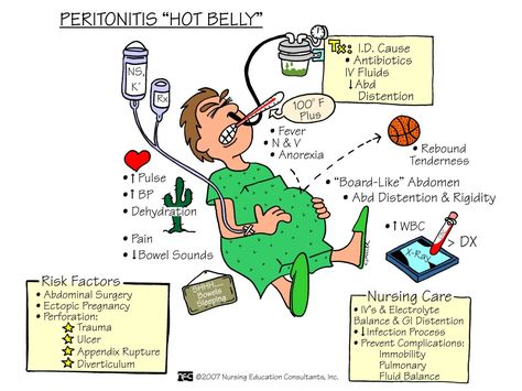 Peritonitis is inflammation of the membranes of the abdominal wall and organs. Peritonitis may be caused by the rupture of infected organs such as the appendix or bowel. Symptoms include strong abdominal (stomach) pain. Peritonitis is life threatening if not treated promptly. The symptoms of peritonitis include: Severe and constant abdominal pain Fever Inability to … Nursing Information, Nursing Board, Med Surg Nursing, Texas Teacher, Teacher Certification, Nursing Mnemonics, Medical Surgical Nursing, Surgical Nursing, Nursing School Survival