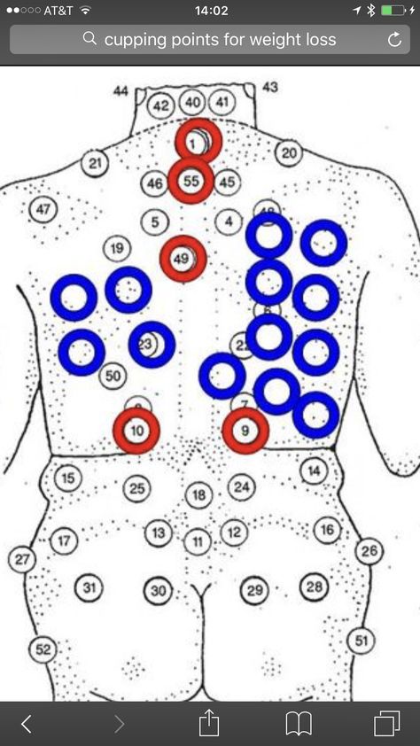 Cupping Placement Chart, Hijama Points, Cupping Points, Cupping Therapy, Acupressure, Acupuncture, Massage, Health, 10 Things