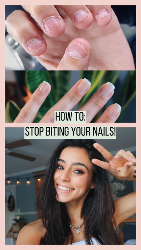 These tips will make you stop biting your nails for good! Stop Biting Nails Remedies, How To Stop Chewing Your Nails, How To Stop Nail Biting, Nail Biting Remedy For Adults, How To Stop Biting Nails, Nail Biting Remedies, Nail Chewing, Biting Fingernails, Stop Biting Your Nails