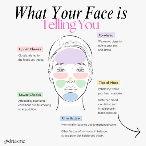 Face mapping is important for understanding hormonal health because it helps identify how different areas of the face correspond to specific internal organs and hormonal imbalances. By examining breakouts, discoloration, or other skin issues in certain facial regions, practitioners can gain insights into underlying hormonal imbalances or health issues, allowing for more targeted and effective treatments. Send this to your skin bestie 👯‍♀️🩷 #skincare #skincaretips #skinhealth #skingoals #s... Face Massage Anti Aging, Hormonal Imbalances, Hormonal Breakouts, Hormonal Health, Facial Tips, Pimples On Face, Lymph Drainage, Face Mapping, Hormone Support