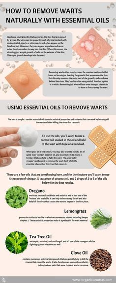 How To Remove Warts Naturally with Essential Oils #OrganicAromas Essential Oils Warts, Warts On Hands, How To Remove Warts, Remove Warts, Lemongrass Tea, Cleaning Painted Walls, Get Rid Of Warts, Deep Cleaning Tips, Cough Remedies