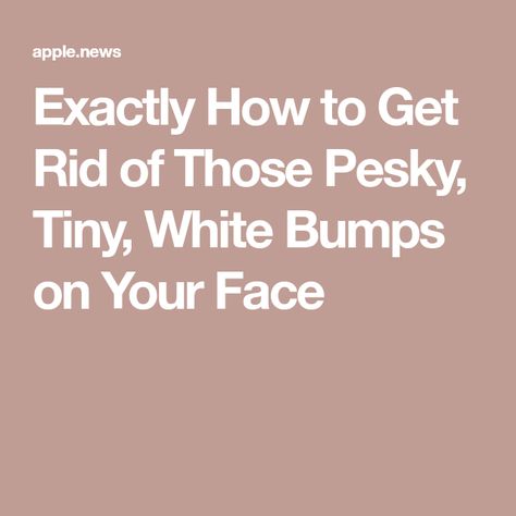 Exactly How to Get Rid of Those Pesky, Tiny, White Bumps on Your Face How To Remove Small Bumps On Face, How To Get Rid Of Little Bumps On Face, How To Remove Tiny Bumps On Face, How To Get Rid Of Tiny Bumps On Face, How To Get Rid Of Small Bumps On Face, Tiny Bumps On Forehead, White Bumps On Face, Small Bumps On Forehead, White Mole