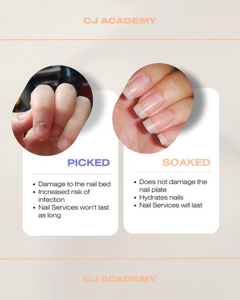 Have you experienced a nail technician ripping off your nails during a removal? This can lead to serious damage to your nail bed, leaving you feeling uncomfortable and in pain. Soak-offs using either cotton wrapped in foil or soaking bowls are the way to go! 🙌 #cjacademyau #cjartistry #thenailconnection #naileducation #nails #nailart #nailpromagazine #nailtraining #acrylicnails #gel #gelnails #nailcourses #sydneynails #troubleshoot #smoothnails #nailstudentcourse #removals Nail Removals -... Nail Infection, Nail Courses, Nail Bed, Beauty Academy, Nail Services, Nail Plate, Nail Pro, Nail Technician, Simple Nails