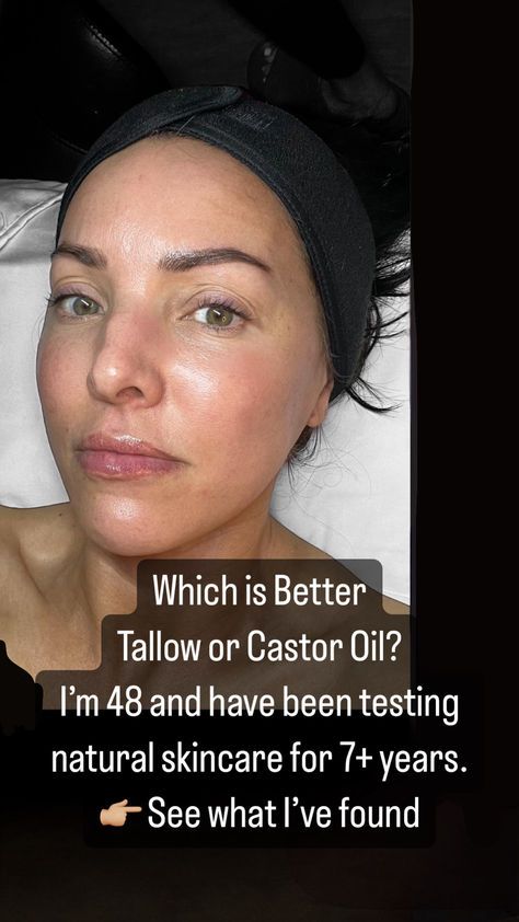 I'm 48 and have been testing skincare for over 7 years. I love natural ingredients and use mostly single ingredient products. Here are my thoughts on castor oil vs tallow. Weekly Skin Care Routine Schedule, Skin Care Routine Schedule, Skincare Schedule, Steps Skincare Routine, Skincare Routine For Sensitive Skin, Weekly Skin Care Routine, Castor Oil For Face, Basic Skincare Routine, Skin Care Must Haves