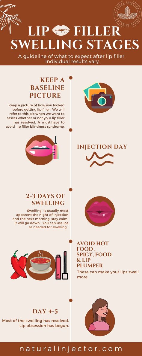 How to Avoid Lip Filler Migration & Botched Lips- 5 Tips YOU NEED to know! — Natural Injector Angelina Jolie Lips, Lip Job, Cosmetic Injections, Large Lips, Cosmetic Injectables, African Ancestry, Lip Filler, Lip Enhancement, Lower Lip