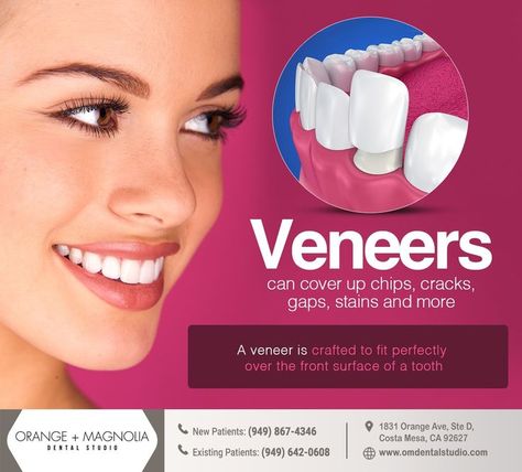 Cosmetic Dentistry Veneers, Dental Social Media, Dental Images, Dental Posts, Dental Posters, Laser Dentistry, Veneers Teeth, Porcelain Veneers, Dental Veneers