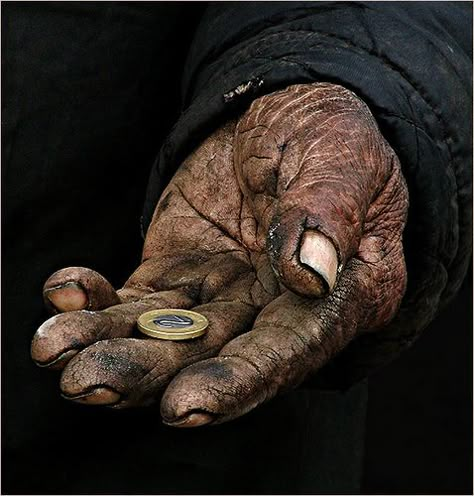 . Hands Of Time, Show Of Hands, Working Hands, Hand Photography, Asthma Attacks, Hand Reference, Poor Children, Old Hands, Human Hand