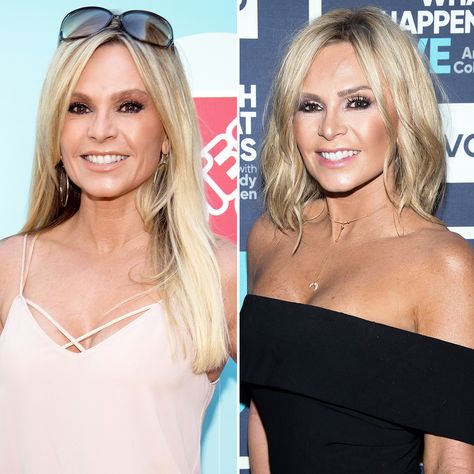 Tamara Judge Hair, Tamra Judge Hair, Tamara Judge, Lower Face Lift, Tamra Judge, Before And After Makeup, Face Lift Surgery, New Hair Styles, Celebrity Plastic Surgery