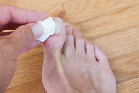 How to Fix a Split Toenail | LEAFtv Split Toenail, Yellow Toe Nails, Toenail Health, Nail Remedies, Split Nails, Vicks Vapor Rub, Fingernail Fungus, Silk Wrap Nails, Toenail Fungus Remedies