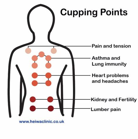 Cupping Therapy for better health Cupping Points, Affinity Photo Tutorial, Benefits Of Cupping, Full Body Massage Techniques, Massage Therapy Business, Body Massage Techniques, Cupping Massage, Point Acupuncture, Massage Therapy Techniques