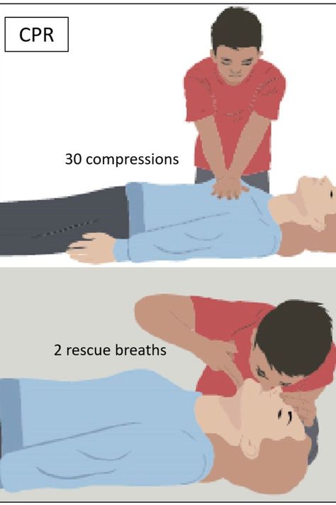 CPR Cardiopulmonary Resuscitation is a first aid procedure used to revive an unresponsive person who is not breathing or is just gasping occasionally First Aid Procedures, Cardiopulmonary Resuscitation, Cpr Training, Certified Nursing Assistant, Safety Training, Group Training, Training Academy, American Heart Association, Nursing Assistant