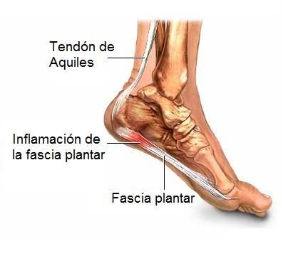 Physiotherapy Clinic, Heel Pain, Foot Pain, Physical Therapy, Stretching, Fitness Models, Pie, Heels