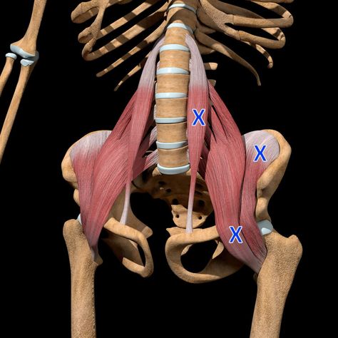 Acupuncture for Psoas Trigger Points — Morningside Acupuncture Snapping Hip Syndrome, Hip Flexor Pain, Psoas Release, Human Muscle Anatomy, Ankle Sprain, Referred Pain, Muscle Stretches, Pinched Nerve, Lower Back Pain Exercises