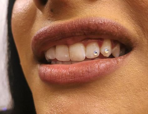 Invisalign Gems, Tooth Gems Simple, Teeth Gems Aesthetic, Simple Tooth Gems, Colored French Nails, Dental Jewelry, Cinnamon Hair, Studera Motivation, Diamond Teeth