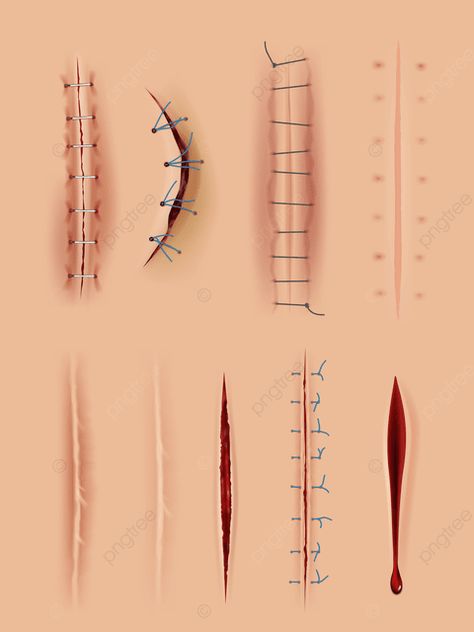 How To Draw Open Wounds, Stitches Tattoo Scar, Wind Drawing, Surgical Suture, Sky Gif, Movie Makeup, Face Anatomy, Stitch Drawing, Scar Tissue