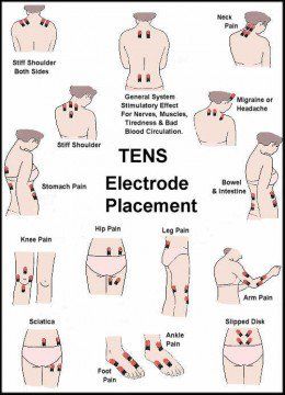 Tens Unit for All Areas of Pain Tens Electrode Placement, Tens Unit Placement, K Tape, Tens Unit, Ten Unit, Hip Pain, Sciatica, Occupational Therapy, Knee Pain