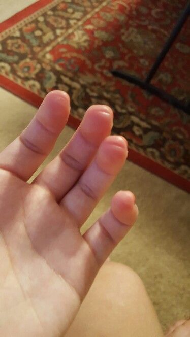 I love having guitar fingers Guitarist Fingers, Guitar Hands, Finger Injury, Guitar Aesthetic, Guitar Fingers, Funny Face Photo, Gentleman Aesthetic, Bass Guitarist, Guitar Photos