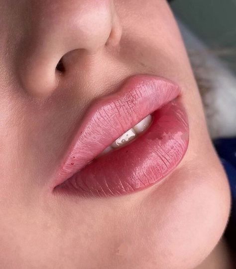 Hydra Gloss Lips, Russian Lips, Gloss Lips, Lips Inspiration, Facial Fillers, Lip Blush, Facial Aesthetics, Lip Filler, Aesthetic Medicine