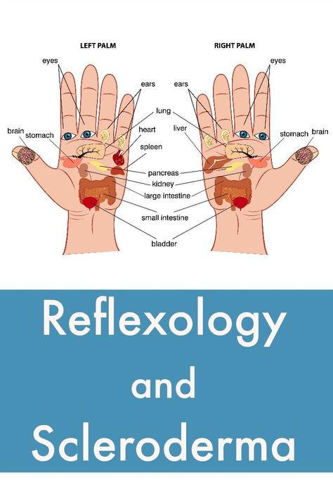 Have you considered reflexology for scleroderma? Reflexology is an ancient practice that's been passed down for thousands of years. #SclerodermaNewsToday Pie Skin, Scleroderma Awareness, Reflexology Points, Reflexology Foot Chart, Foot Reflexology Massage, Hand Reflexology, Reflexology Chart, Reflexology Massage, Foot Reflexology