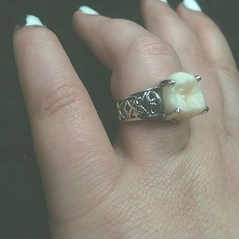 A DIAMOND OR A TOOTH? This Woman’s Engagement Ring Is Her Fiancé’s Wisdom Tooth! Would you wear a tooth on your finger? Wisdom Tattoo, Sensitive Teeth Remedy, Wisdom Tooth, Tooth Ring, Emergency Dentist, Teeth Implants, Dental Bridge, Teeth Jewelry, Dental Humor