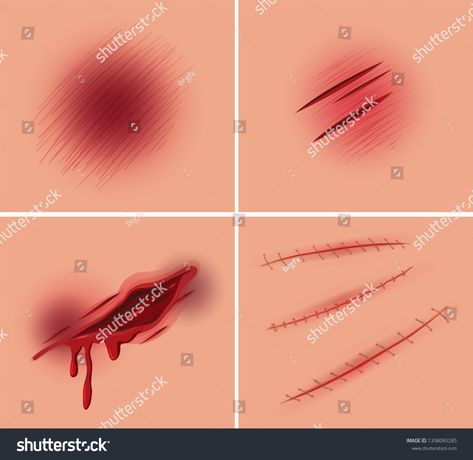 Set of open wound illustration #Ad , #spon, #open#Set#illustration#wound Open Wounds Drawing Reference, How To Draw Wounds, Drawing Wounds, Wound Painting, Wounds Drawing Reference, Wind Drawing, Ceramic Bust, Drawing Blood, Paint Tutorials