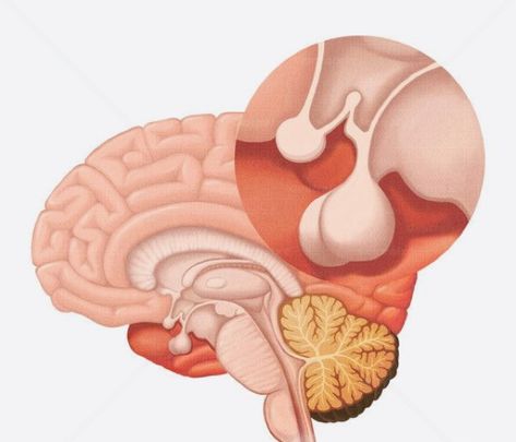 Healing Reflexology, Brain Models, Pineal Gland, Medical Anatomy, Neurology, Anatomy Art, Human Anatomy, Medical School, Aesthetic Art