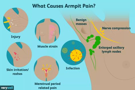 Lymph Nodes Armpit, Menstrual Symptoms, Referred Pain, Health Living, Sweat Gland, Muscle Strain, Lymph Nodes, Natural Health Tips, Good Mental Health