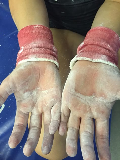 Gymnast hands! Gymnastics Rips Hands, Gymnastics Rips, Gymnastics Vibes, Artistic Gymnast, Gymnastics Pics, Gymnastics Aesthetic, Gymnastics Posters, Aerial Gymnastics, Acro Gymnastics