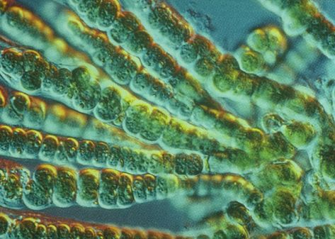 Blue-Green Algae - Cyanobacteria Microscopic Algae, Blue Algae, Improve Your Memory, Blue Green Algae, Marine Algae, Soy Beans, Green Algae, Bio Art, Improve Brain Function