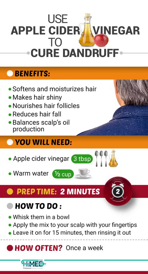 Vinegar For Dandruff, Natural Dandruff Remedy, Hair Mask For Dandruff, Dandruff Solutions, Vinegar For Hair, Rid Of Dandruff, Apple Cider Vinegar For Hair, Hair Mask Recipe, Homemade Hair Treatments