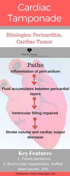 Cardiac tamponade: E Cardiac tamponade: Etiologies Pathophysiology and Key Features. Nursing | Nursing school | Nursing student | Pathophysiology | Cardiovascular | Cardiac Tamponade | Pericarditis Cardiac Pathology, Cardio Nursing, Paramedic Training, Cardiac Tamponade, Nursing School Clinicals, Nursing Tools, University Scholarships, Cna School, Cardiac Sonography