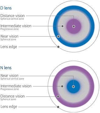 The New Biofinity Multifocal Fitting Guide - Eyedolatry Ophthalmic Assistant, Human Skeletal System, Multifocal Lenses, Eye Anatomy, Skeletal System, Old Technology, Bifocal Glasses, Skeletal, Prescription Eyeglasses