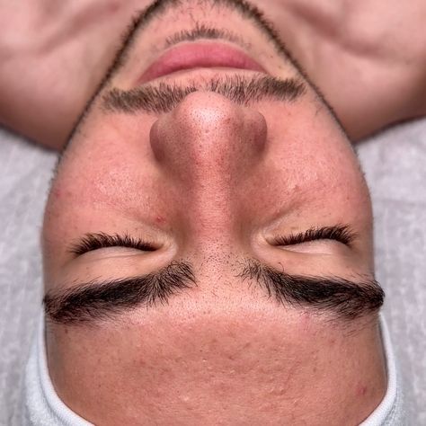 A facial with me goes a little like this….😶‍🌫️ Book with the link in bio or DM for skincare consultation/questions ❤️‍🔥💆🏻‍♀️💆🏻‍♂️✨🌿 . . . #tampafacials #tampathingstodo #tampaspa #facialsstampa #esteticatampa #acnefacial Skincare Consultation, Acne Facial, Facial, Spa, Things To Do