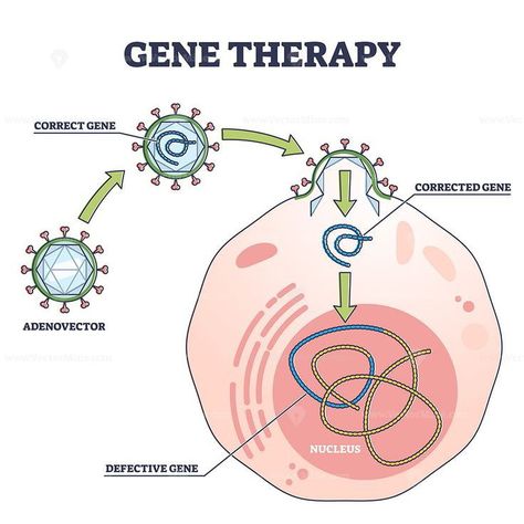 Genetic Diseases Poster, Project Biology, Therapy Infographic, Somatic Cell, Human Genome, Science Illustration, Gene Therapy, Genetic Disorders, Technology Wallpaper