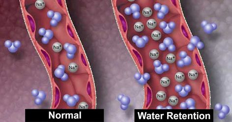 Period Cramp, Most Nutritious Vegetables, Reduce Water Retention, Puffy Face, Water Retention Remedies, About To Pop, Swollen Ankles, Retaining Water, Fluid Retention