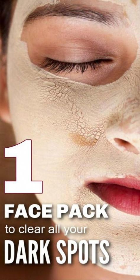 Brown Spots On Skin, Dark Spots On Face, Brown Spots Removal, Brown Spots On Face, Dark Spots On Skin, Face Pack, Skin Spots, Spots On Face, Remove Dark Spots