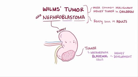 Wilms Tumor, Kidney Tumor, Learn Faster, Pediatrics, Anatomy, Meant To Be