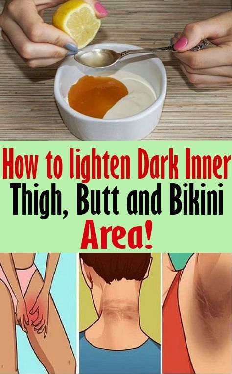 How to Lighten Dark Inner Thighs, Butt and Bikini Area! Dark Inner Thighs, Dark Armpits, Dark Underarms, Health Planner, Healthy Routine, Micro Mini Skirt, Inner Thigh, Health Facts, Health Remedies