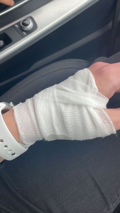 Bandage Arm Aesthetic, Bandage Medical Hand Snap, Pics Of Hand With Bandage, Hand Wrapped In Bandages, Wrist With Bandages, Bandage Leg In Hospital, Injury Aesthetic, Fracture Hand Plaster Girl, Fractured Arm