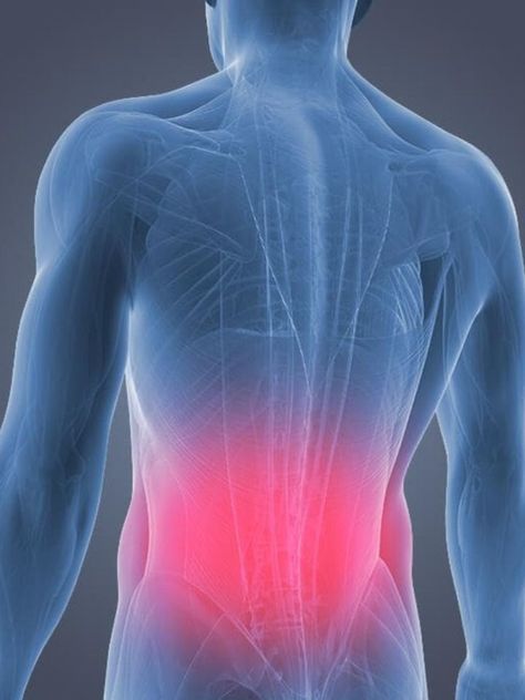 10 Ways to Manage Low Back Pain at Home Lower Back Pain Causes, Cauda Equina, Spine Problems, Severe Back Pain, Middle Back Pain, Sports Therapy, Back Pain Remedies, Upper Back Pain, Lower Back Pain Relief