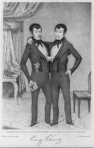 Eng and Chang Bunker: The World's First Siamese Twins ... Siamese Twins, Two Heads, High Quality Art Prints, Find Art, Photo Frame, Photo Printing, Giclee Print, Photo Image, Twins