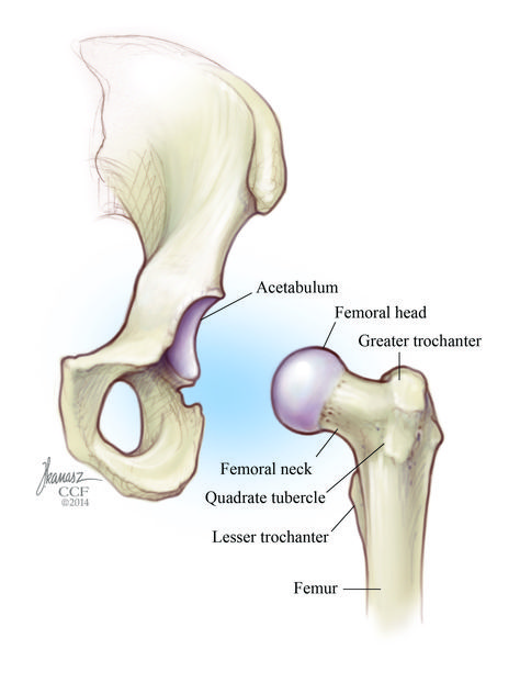 Hip Labral Tear: Symptoms, Causes, Treatments Hip Labral Tear, Torn Labrum, Hip Dislocation, Sagittal Plane, Hip Problems, Hip Dysplasia, Cleveland Clinic, Pelvic Pain, Hip Pain