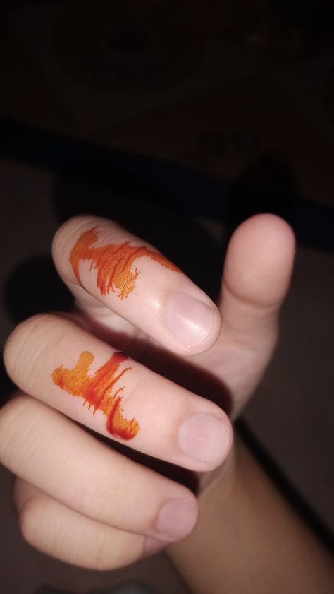 Burned Hand Pic, Fake Injury, Alphabet Letters Images, J Names, Eating Food Funny, Hospital Admit Hand Pics, Funny Images With Quotes, Beautiful Love Images, Snap Streak Ideas Easy