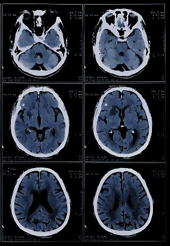 Biopsychology Aesthetic, Neurobiology Aesthetic, Radiology Student, Medical Student Motivation, Med School Motivation, Medical School Motivation, Medicine Student, Medical Aesthetic, Student Motivation