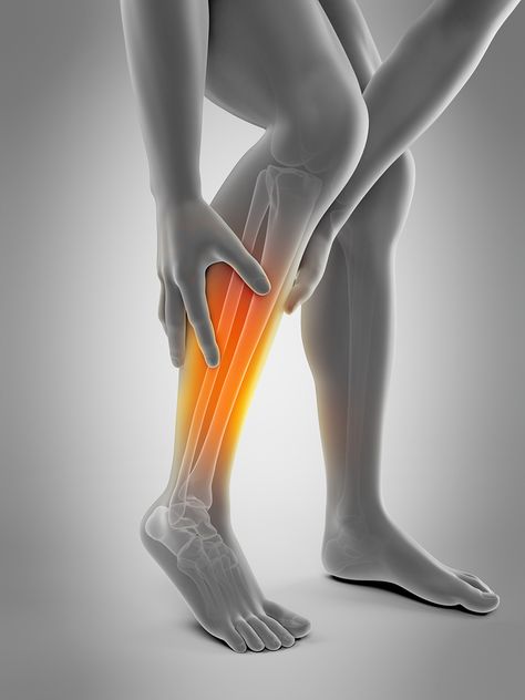 What To Do If Your Shin Splints Won’t Go Away Gastrocnemius Muscle, Calf Cramps, Baby Feeding Schedule, Vitamin Deficiency, Leg Cramps, Shin Splints, Muscle Spasms, Old Shoes, Leg Muscles